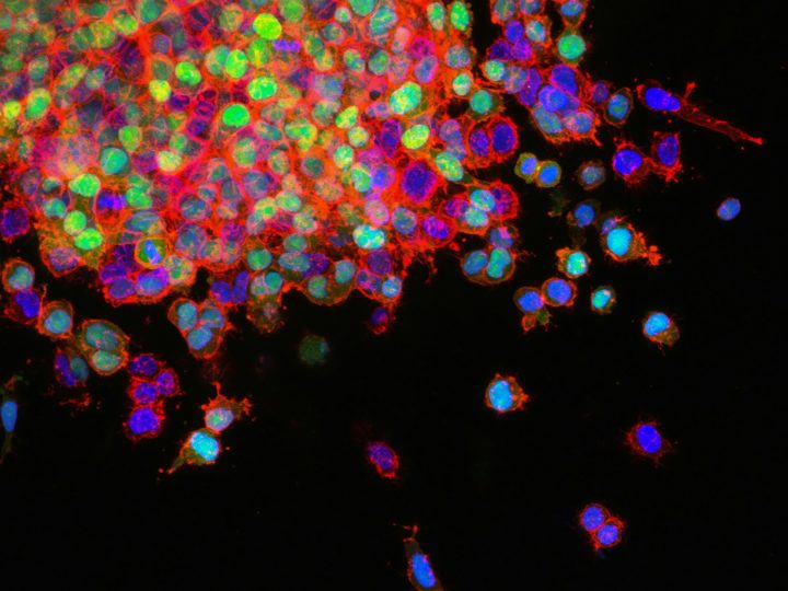 Orion aloitti uuden syöpätutkimuksen Espoosta käsin